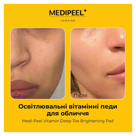 MEDI-PEEL - TAMPON ÉCLAIRCISSANT VITAMINE DEEP-TOX (1PC)