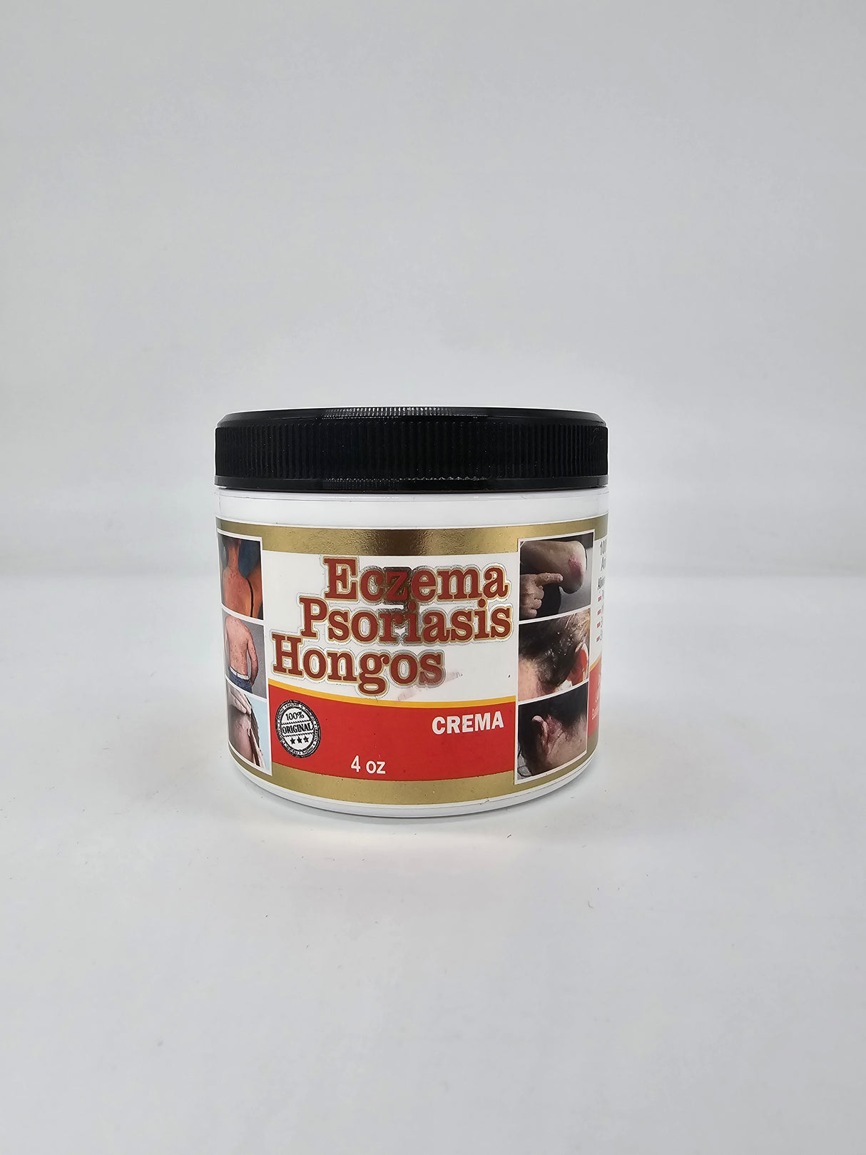 MX- ECZEMA /PROSIASIS/ HONGOS- CREMA- 1PC